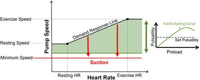 A Sensorless Modular Multiobjective Control Algorithm for Left Ventricular Assist Devices: A Clinical Pilot Study